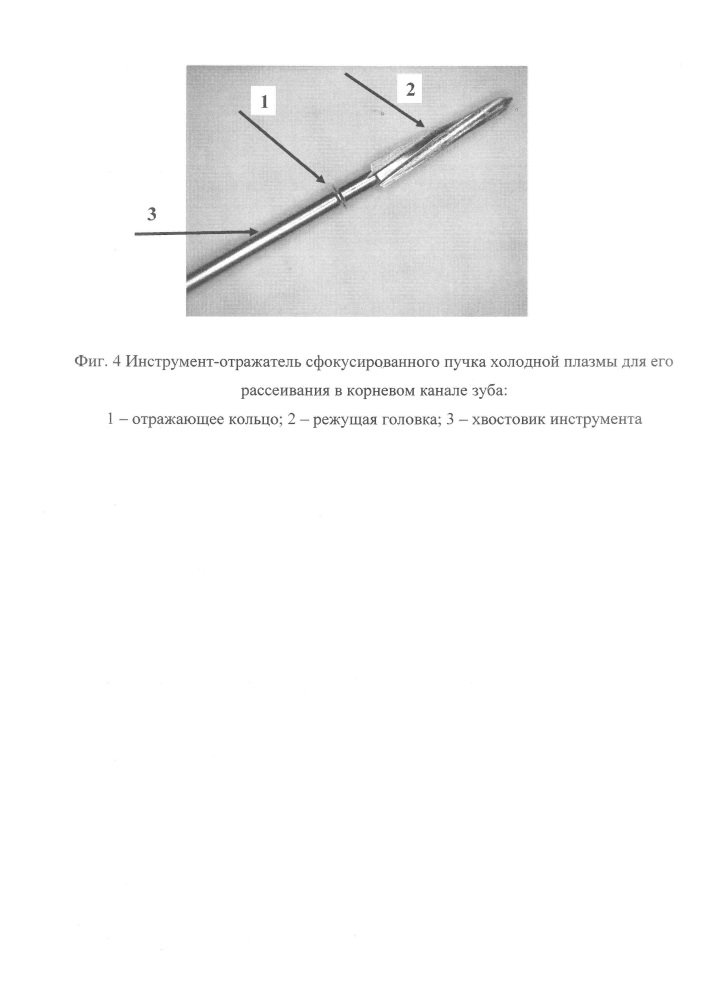 Способ лечения острого апикального периодонтита (патент 2665177)