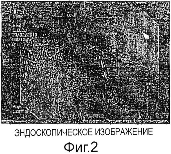 Твердая композиция для перорального введения красителей и их диагностическое применение (патент 2561034)