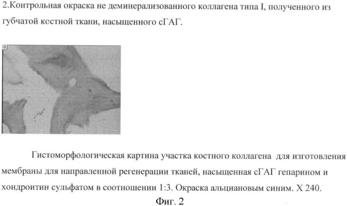 Мембрана для использования при направленной регенерации тканей (патент 2367475)