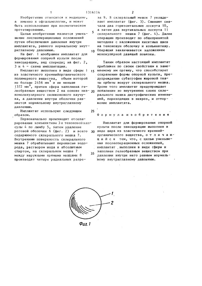 Имплантат для формирования опорной культи после эвисцерации (патент 1316114)