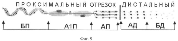 Способ удлинения поврежденного нерва (патент 2398523)