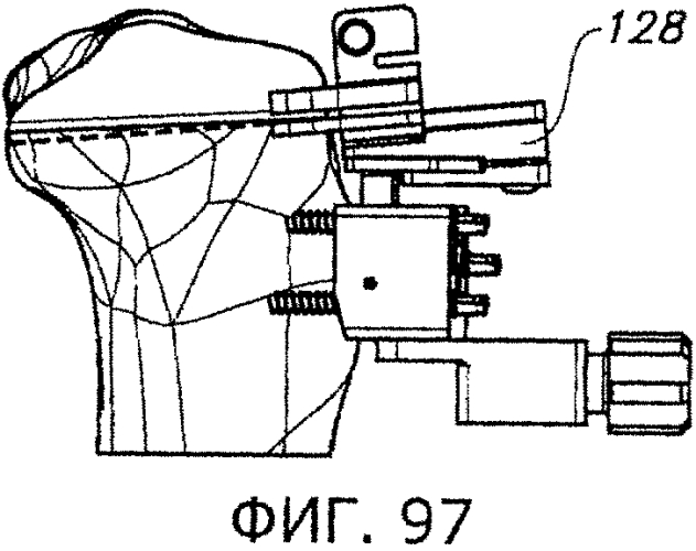 Способы и устройства для артропластики коленного сустава (патент 2570163)