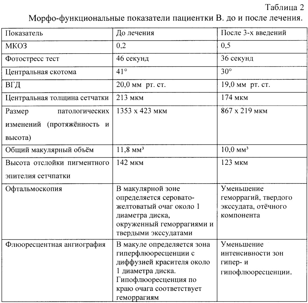 Способ пролонгации и усиления терапевтического эффекта действия ингибиторов ангиогенеза при лечении неоваскулярных форм макулярных дегенераций (патент 2661621)