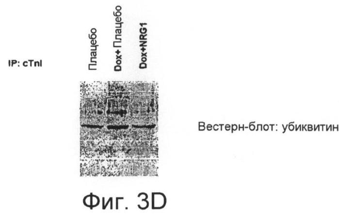 Способы выявления сердечных нарушений (патент 2498309)