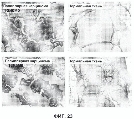 Новые антипролиферативные антитела (патент 2451689)