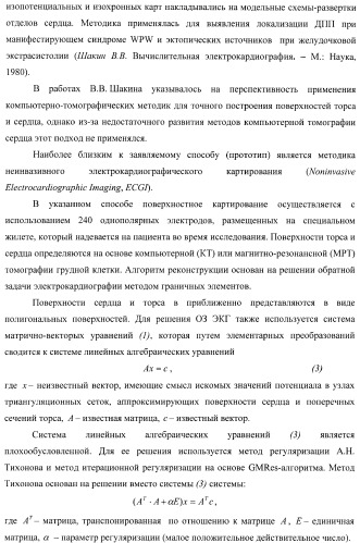 Способ неинвазивного электрофизиологического исследования сердца (патент 2417051)