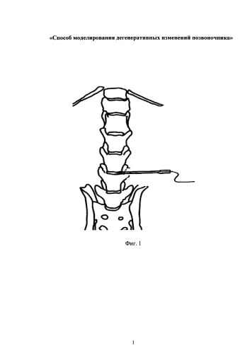Способ моделирования дегенеративных изменений позвоночника (патент 2584136)