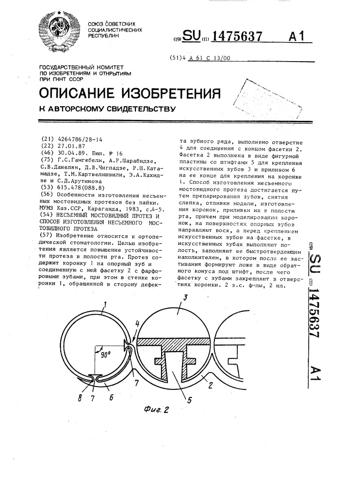 Несъемный мостовидный протез, и способ изготовления несъемного мостовидного протеза (патент 1475637)