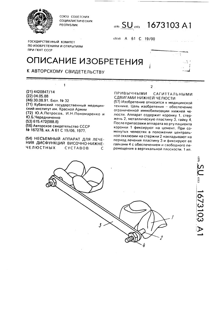 Несъемный аппарат для лечения дисфункций височно- нижнечелюстных суставов с привычными сагиттальными сдвигами нижней челюсти (патент 1673103)