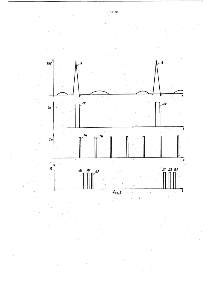 Устройство для выделения сердечной аритмии (патент 651785)