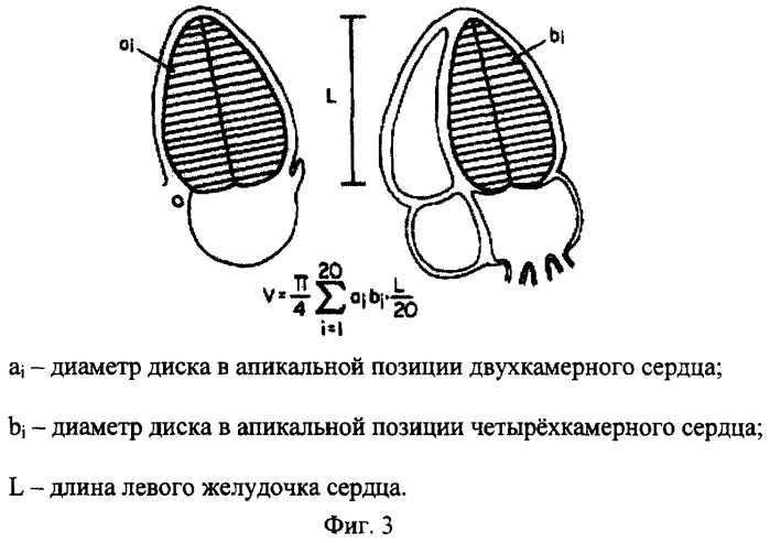 Способ определения основных функциональных показателей миогемодинамики сердца (патент 2264786)