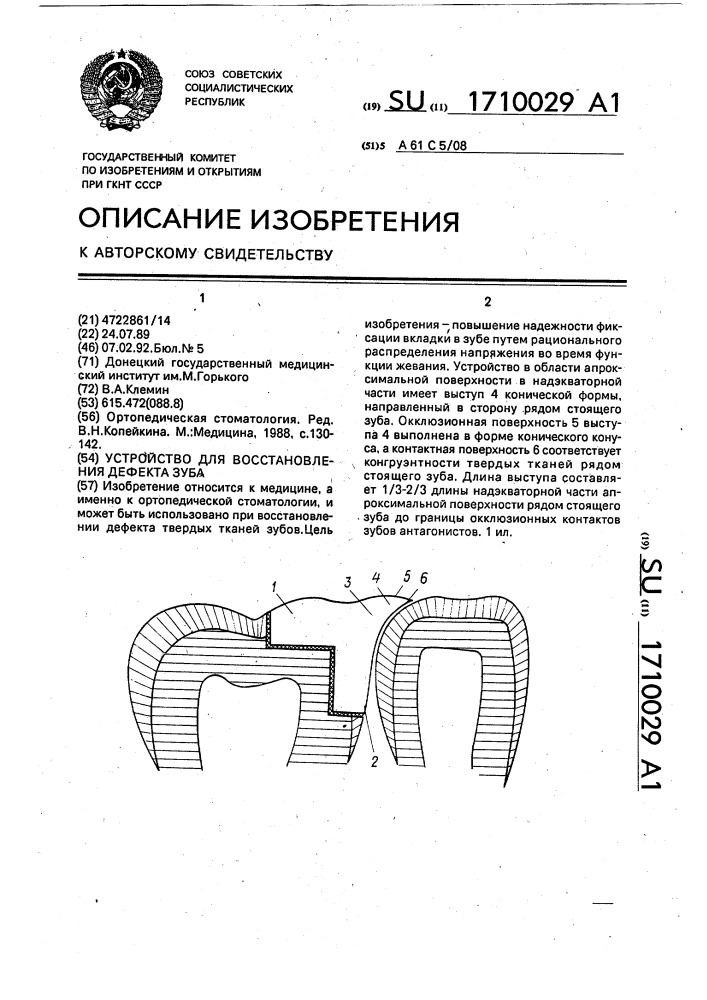 Устройство для восстановления дефекта зуба (патент 1710029)