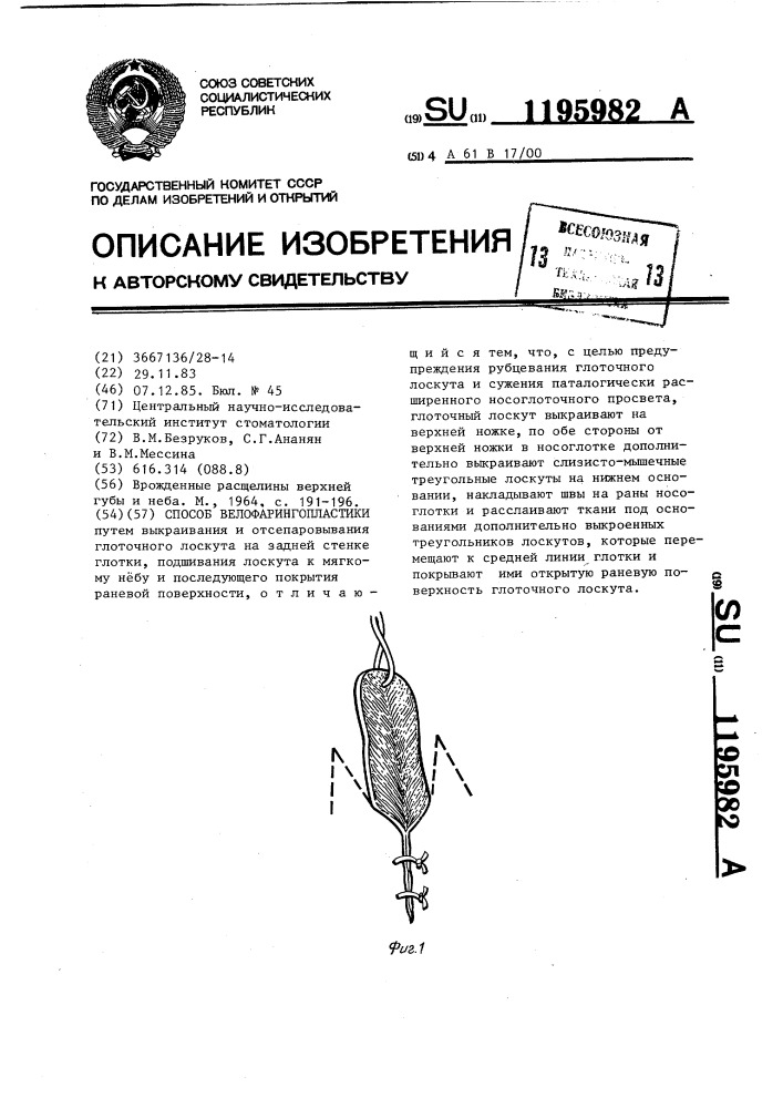 Способ велофарингопластики (патент 1195982)