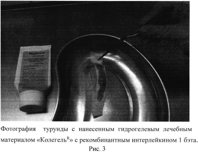 Способ превентивной терапии ринальных осложнений после травмы носа (патент 2559587)