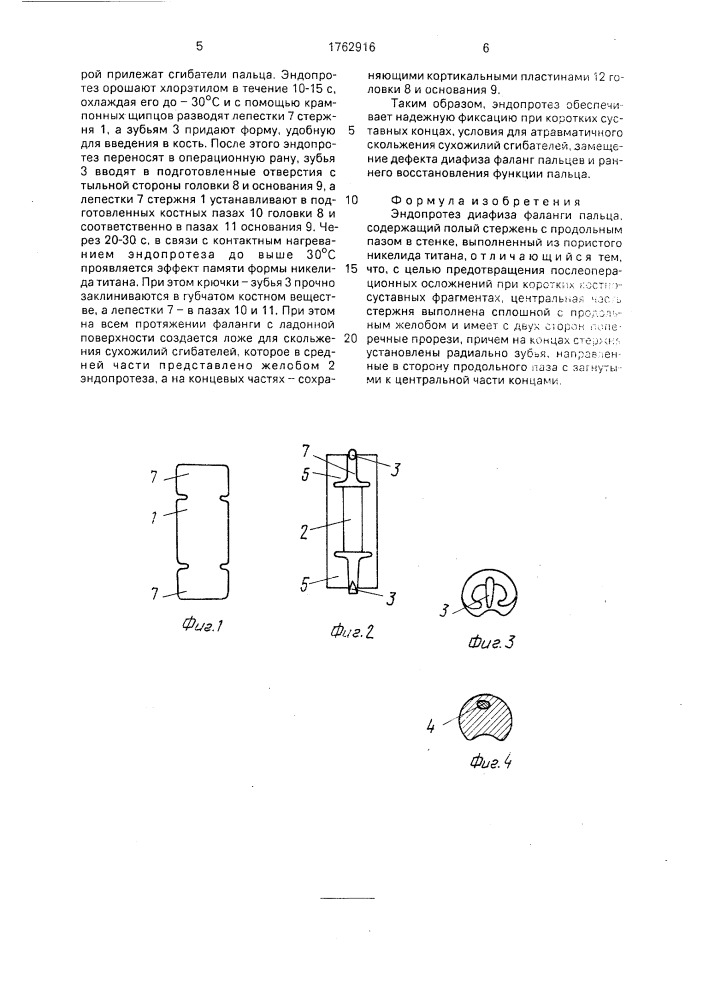 Эндопротез диафиза фаланги пальца (патент 1762916)