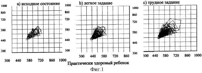 Способ диагностики состояния цнс (патент 2313277)