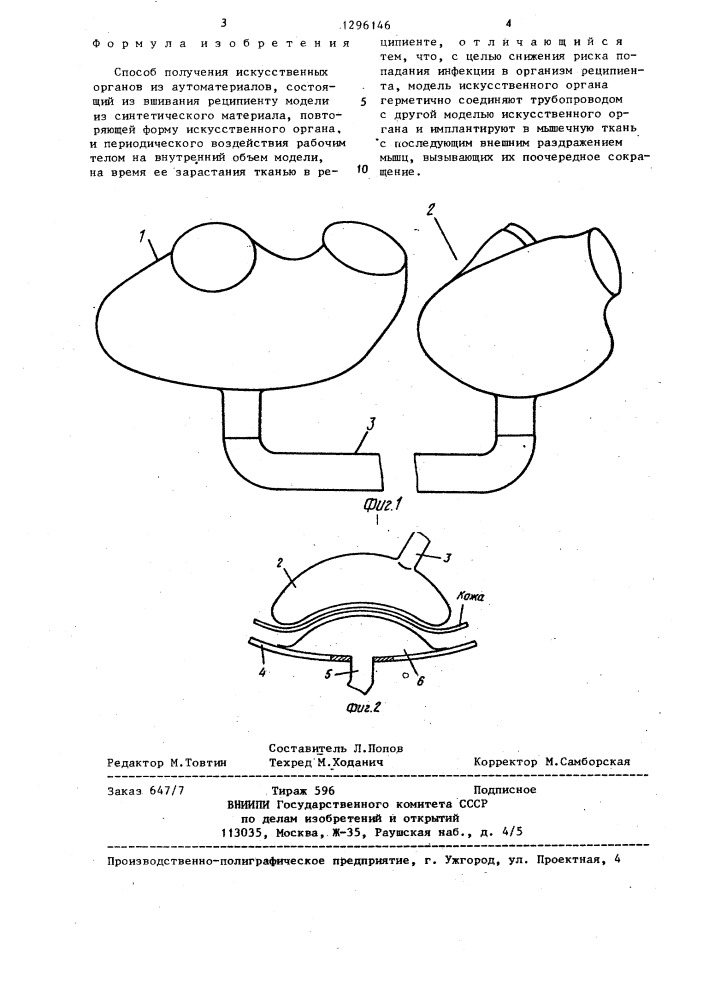Способ получения искусственных органов из аутоматериалов (патент 1296146)