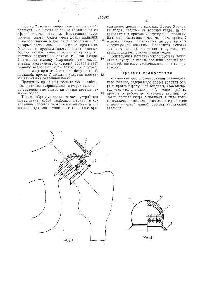 Устройство для протезирования тазобедренногосустава (патент 355952)
