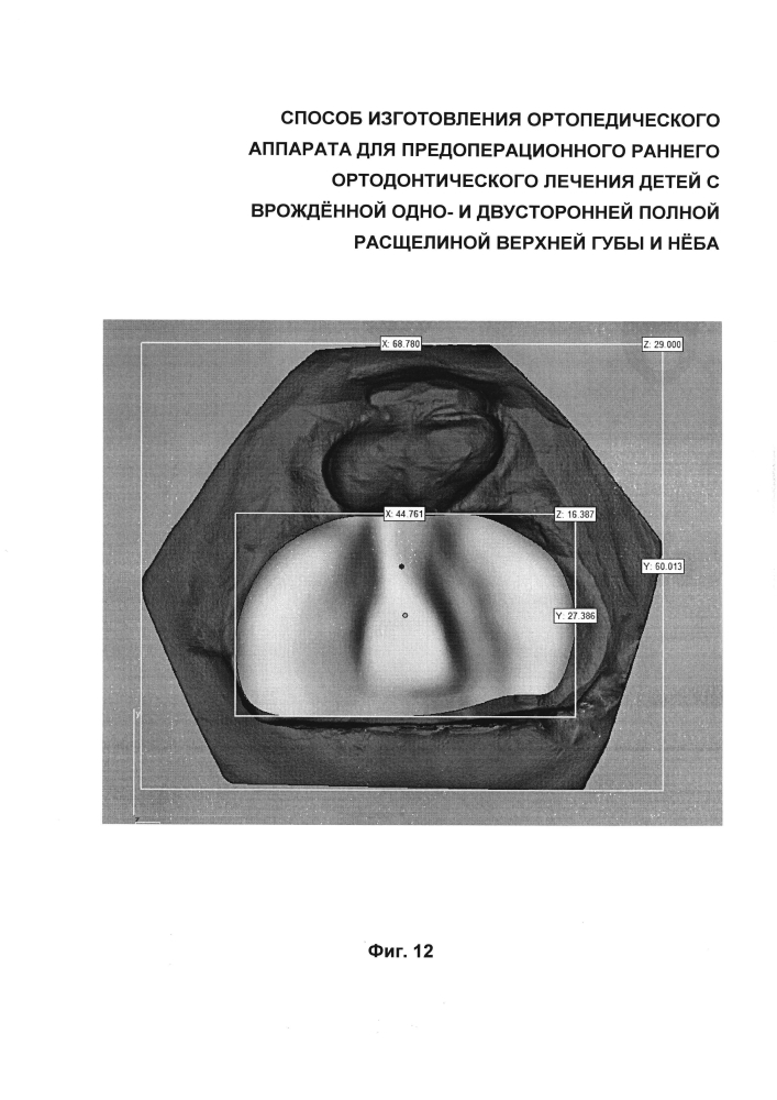 Способ изготовления ортопедического аппарата для предоперационного раннего ортодонтического лечения детей с врождённой одно- и двусторонней полной расщелиной верхней губы и нёба (патент 2599373)