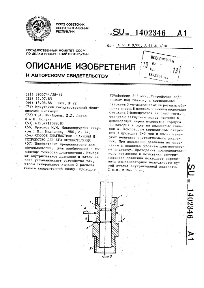 Способ диагностики глаукомы и устройство для его осуществления (патент 1402346)