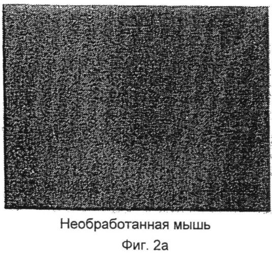 Лечение и предупреждение нейродегенеративных заболеваний с использованием генной терапии (патент 2471487)