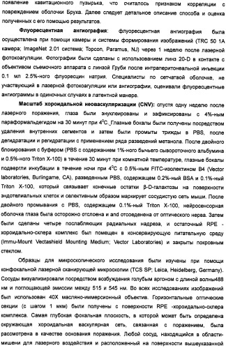 Способ лечения заболеваний, связанных с masp-2-зависимой активацией комплемента (варианты) (патент 2484097)