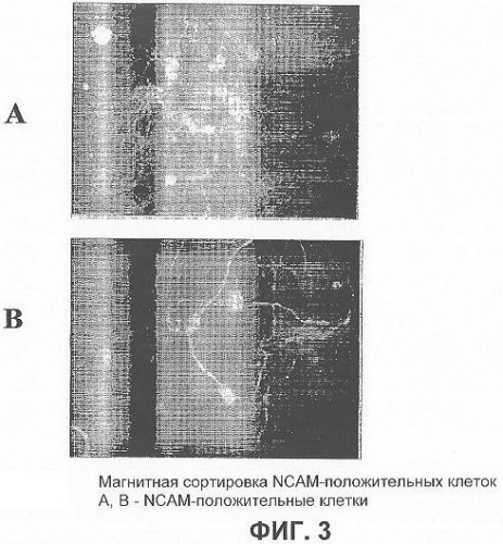 Получение терминально дифференцированных дофаминергических нейронов из эмбриональных стволовых клеток человека (патент 2345133)