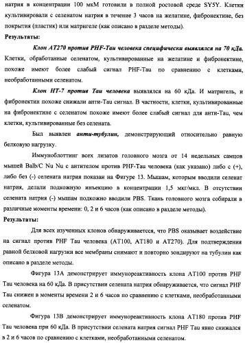 Лечение нейродегенеративных заболеваний (патент 2489155)