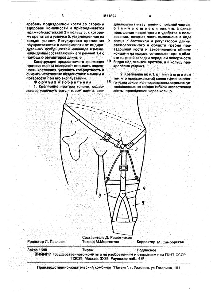 Крепление протеза голени (патент 1811824)