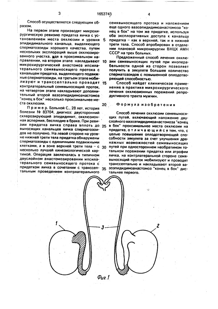 Способ лечения окклюзии семявыносящих путей (патент 1653743)