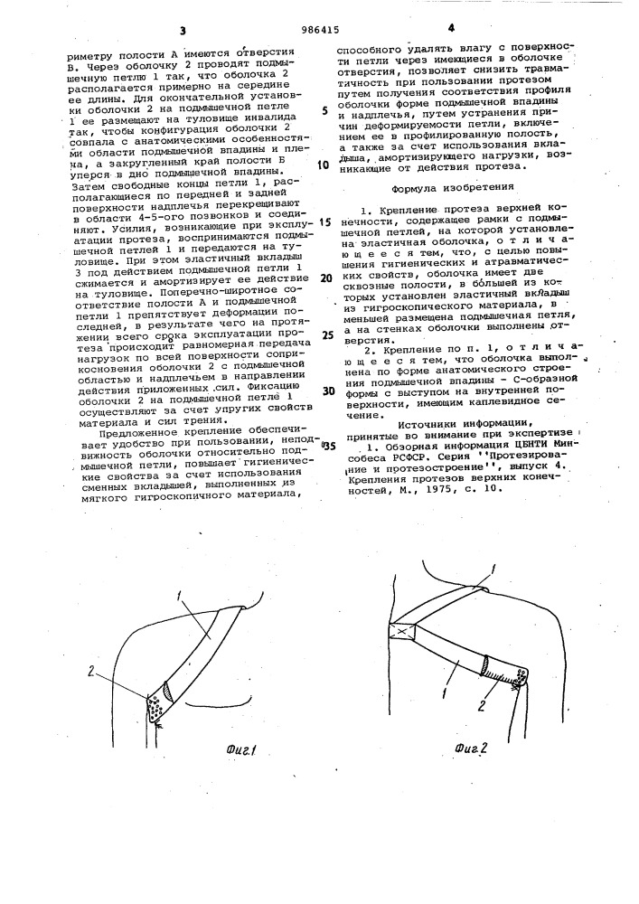 Крепление протеза верхней конечности (патент 986415)