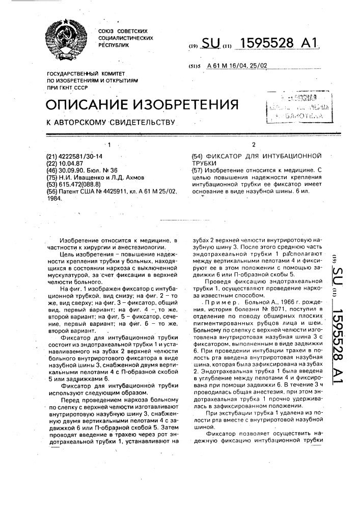 Фиксатор для интубационной трубки (патент 1595528)