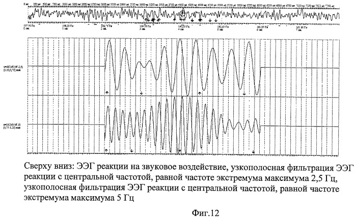 Способ определения синхронизации и десинхронизации биоэлектрической активности мозга (патент 2454172)