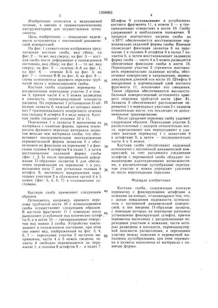 Костная скоба (патент 1598993)