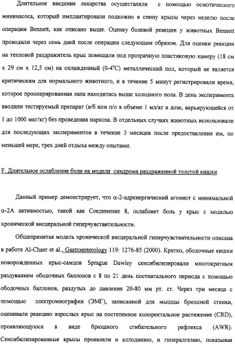 Способы и композиции для снятия боли (патент 2329062)