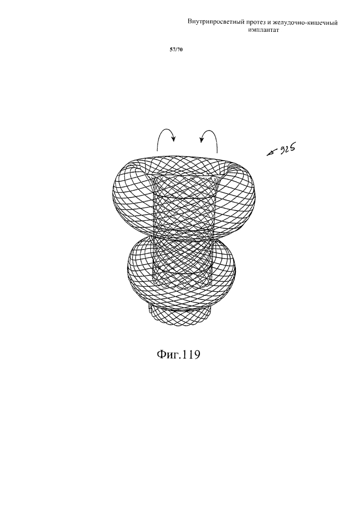 Внутрипросветный протез и желудочно-кишечный имплантат (патент 2626885)