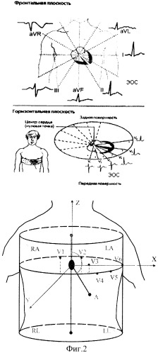Устройство для регистрации электрокардиосигналов (патент 2269290)