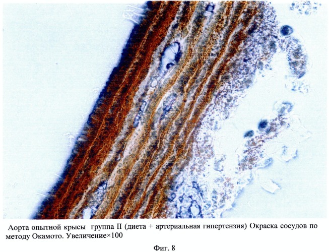 Способ моделирования атеросклероза (патент 2500041)