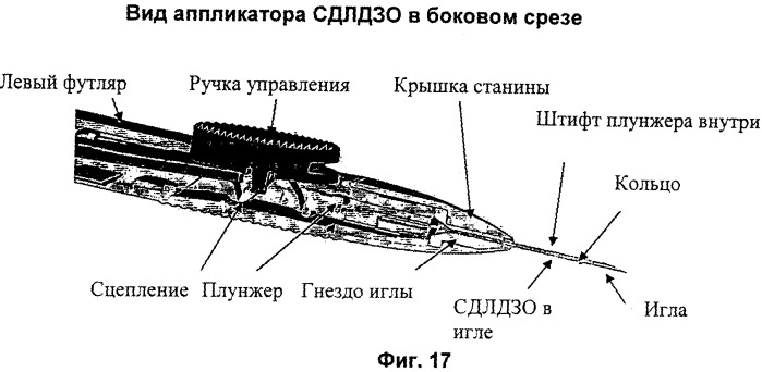 Глазной имплантат, изготавливаемый способом двойной экструзии (патент 2389479)