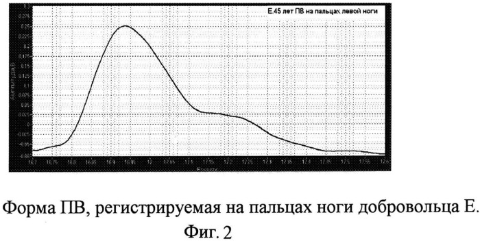 Способ измерения скорости распространения пульсовой волны (патент 2542093)