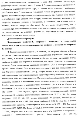 Способ получения фактора, связанного с контролем над потреблением пищи и/или массой тела, полипептид, обладающий активностью подавления потребления пищи и/или прибавления в весе, молекула нуклеиновой кислоты, кодирующая полипептид, способы и применение полипептида (патент 2418002)