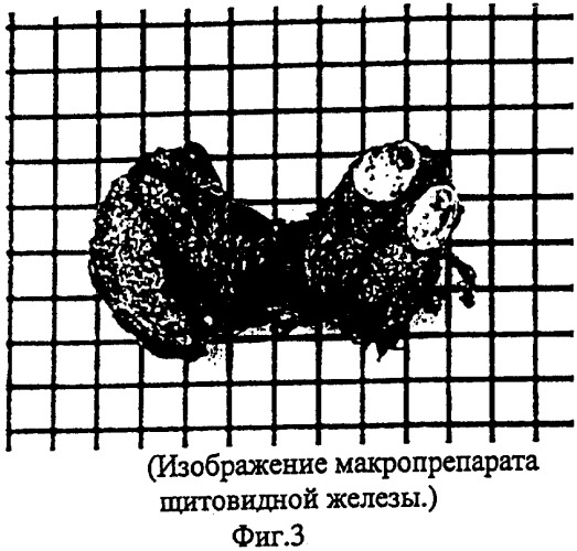 Способ микроскопического исследования образца (патент 2318201)