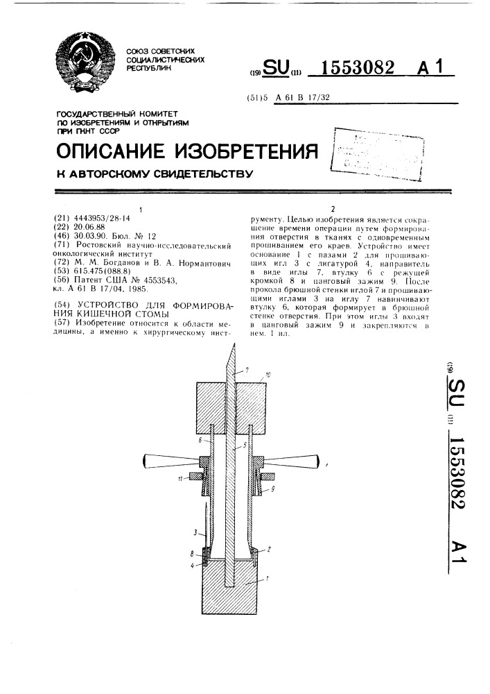 Устройство для формирования кишечной стомы (патент 1553082)