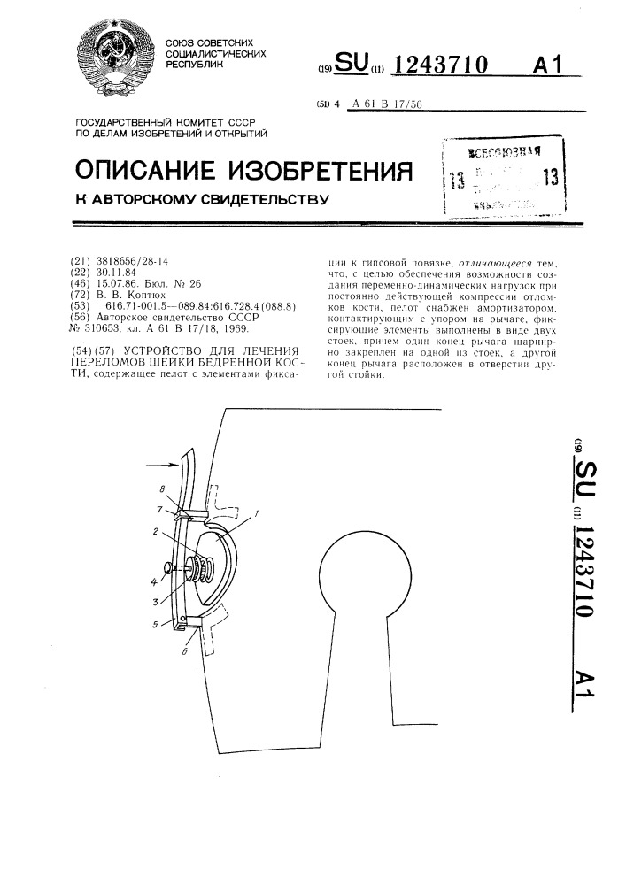 Устройство для лечения переломов шейки бедренной кости (патент 1243710)