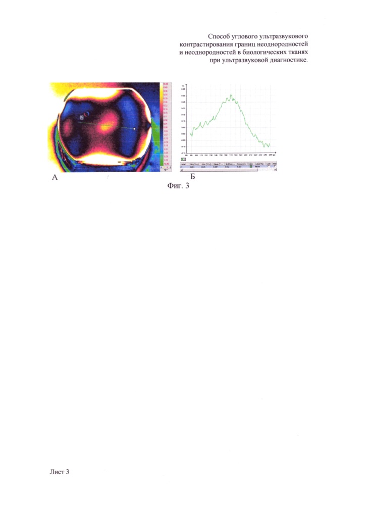 Способ углового ультразвукового контрастирования границ неоднородностей и неоднородностей в биологических тканях при ультразвуковой диагностике (патент 2648880)