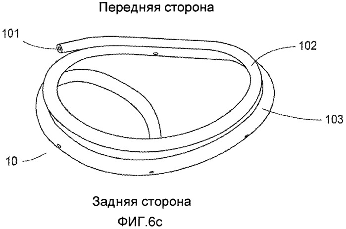 Устройство и способ для уменьшения размера клапана сердца (патент 2491035)