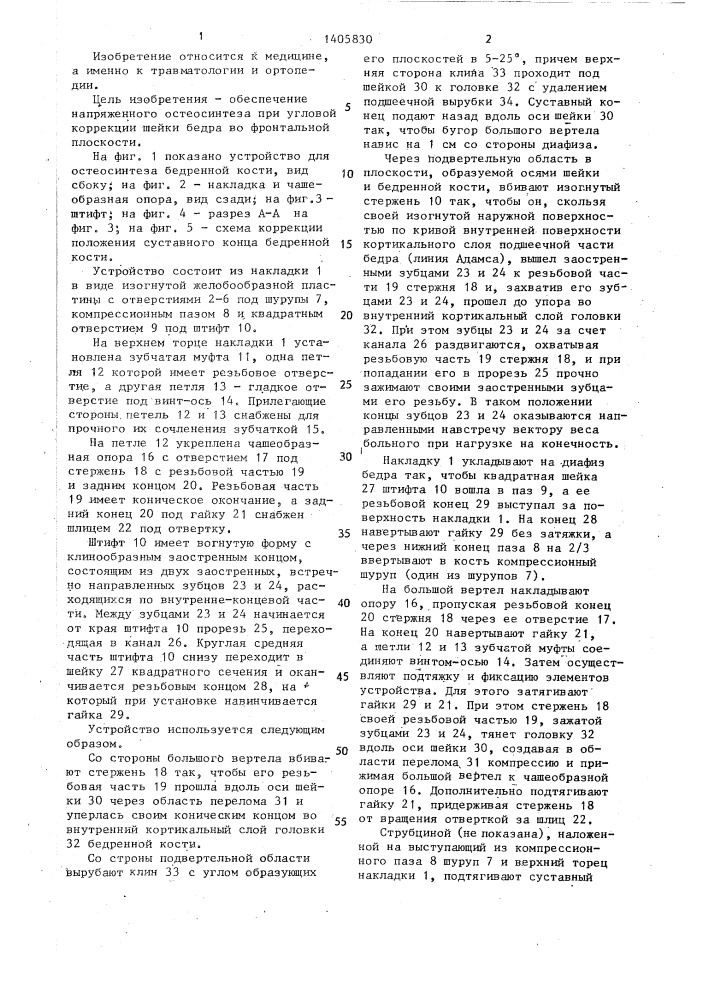 Устройство р.в.никогосяна и б.н.балашева для остеосинтеза бедренной кости (патент 1405830)