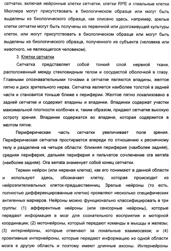 Соединения, представляющие собой алкинилфенильные производные, для лечения офтальмических заболеваний и расстройств (патент 2470910)