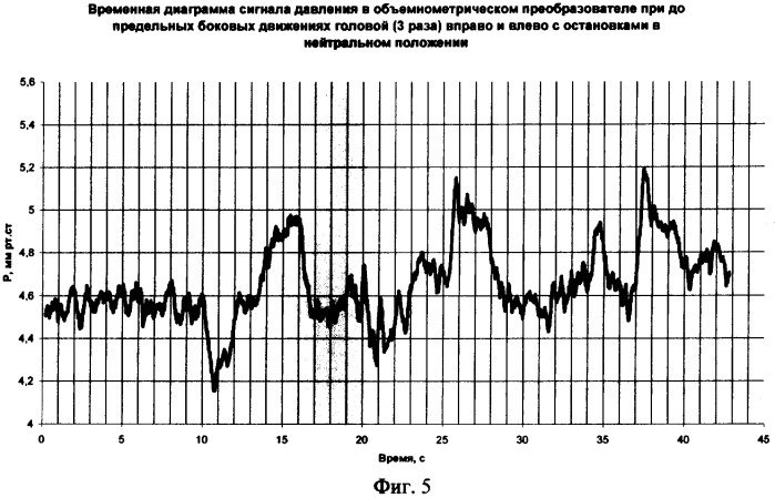 Способ обследования краниальных тканей и устройство для его осуществления (патент 2372837)