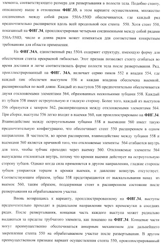 Стент из скользящих и блокирующих элементов (патент 2429801)